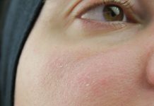 Težava imenovana: koža ima “prhljaj”, ti pa želiš čim lepše nanesti podlago :O Boj proti luskasti koži - pred nanosom by Gabi Gejba Parokeets